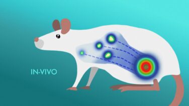 Descubren cómo detectar el cáncer de piel antes de que se extienda