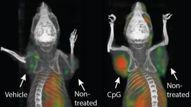 Vacunas que patrullan contra el cáncer, una realidad en ratones