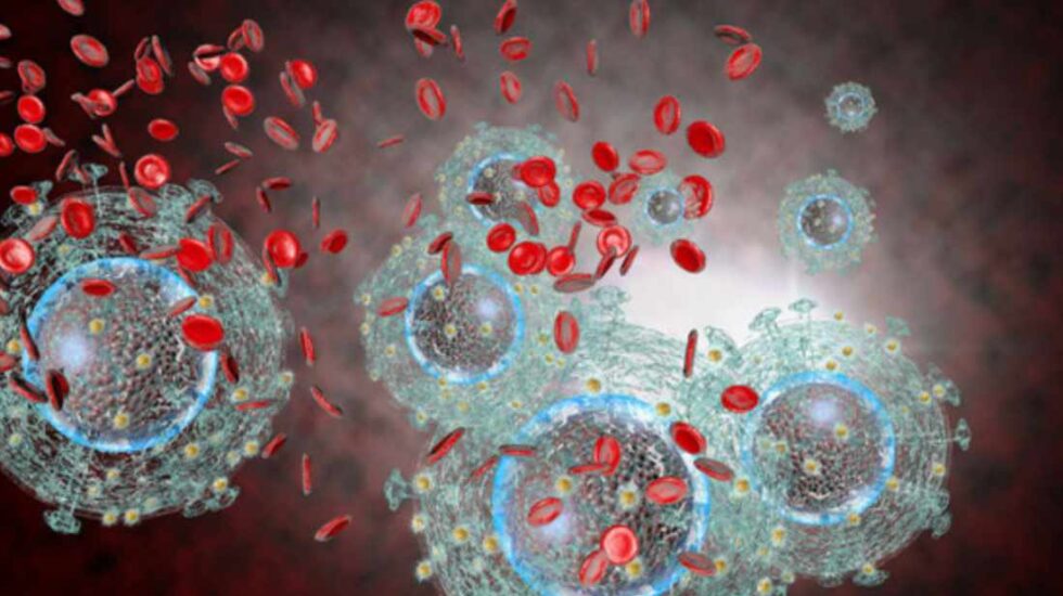 El VIH daña el sistema inmunitario mediante la destrucción de los glóbulos blancos que combaten las infecciones.
