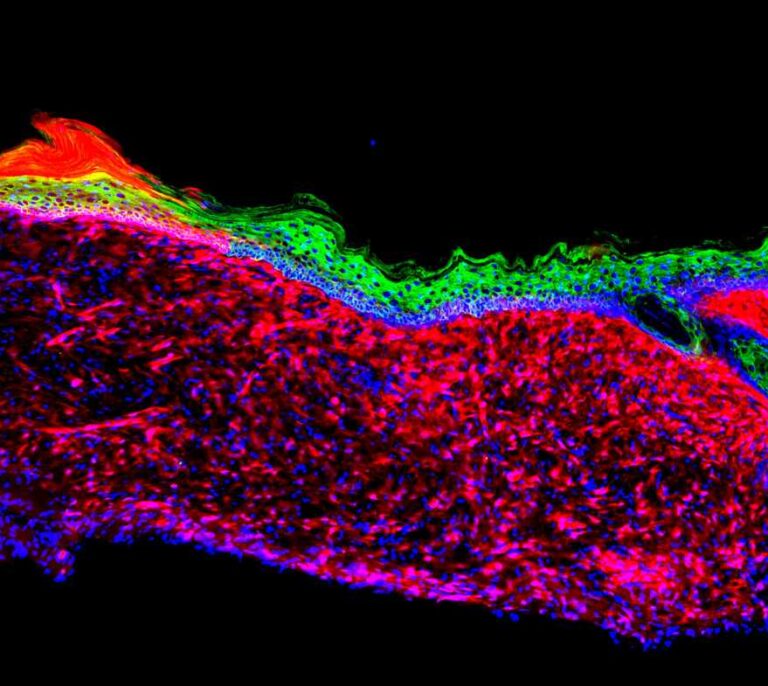 El equipo de Izpisúa consigue regenerar piel reprogramando células en una herida