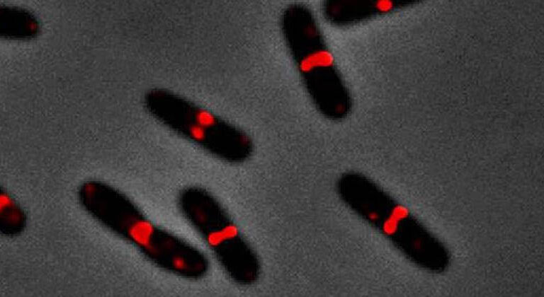 Científicos españoles encuentran la manera de frenar bacterias multirresistentes