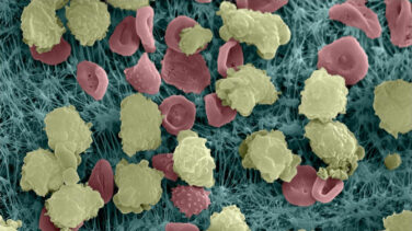 Descubren el reloj biológico de infartos e infecciones