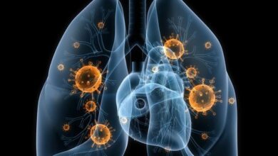 Un nuevo tratamiento de inmunoterapia rebaja un 27% el riesgo de muerte del cáncer de pulmón