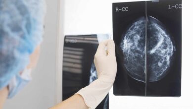 El cáncer de mama afecta cada vez más a mujeres jóvenes