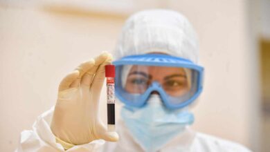 Los laboratorios privados ya han hecho el 6% de los PCR en Cataluña