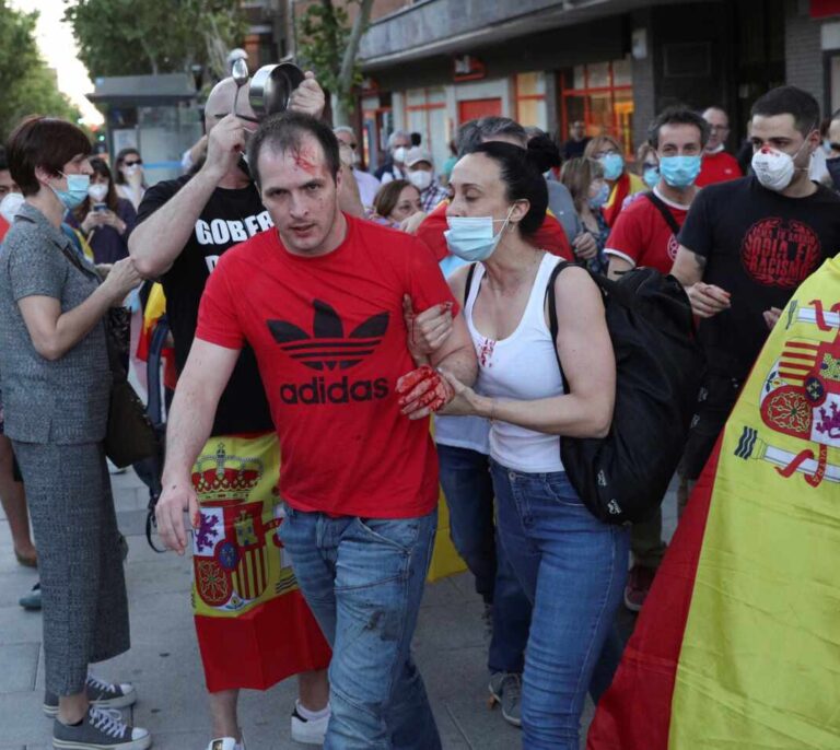 Almeida traslada su "firme condena" por la agresión en la cacerolada de Moratalaz