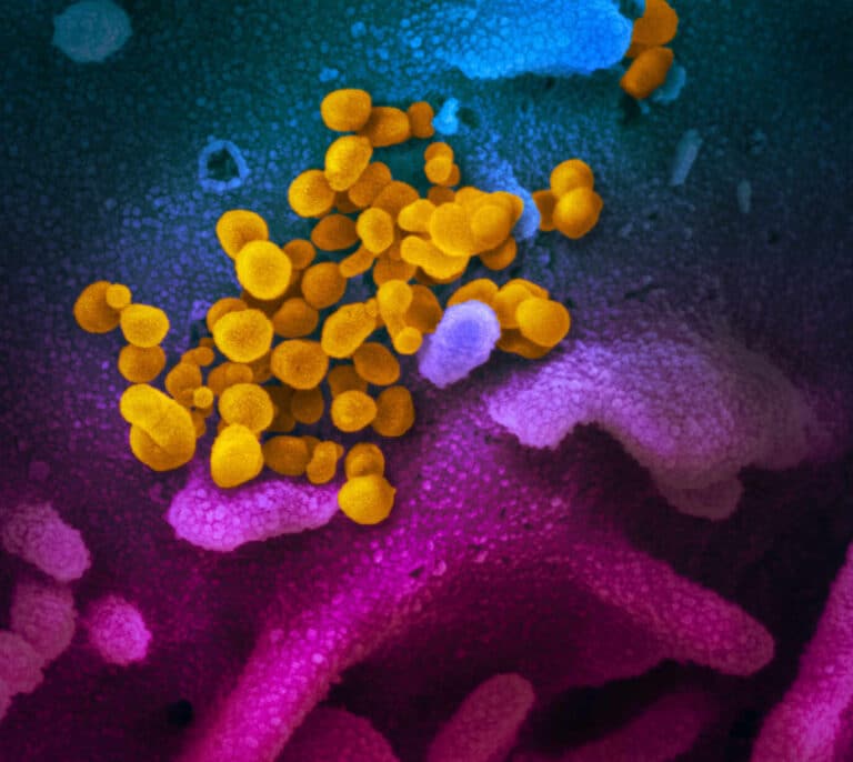 Seis preguntas clave sobre la nueva cepa de coronavirus descubierta en el Reino Unido