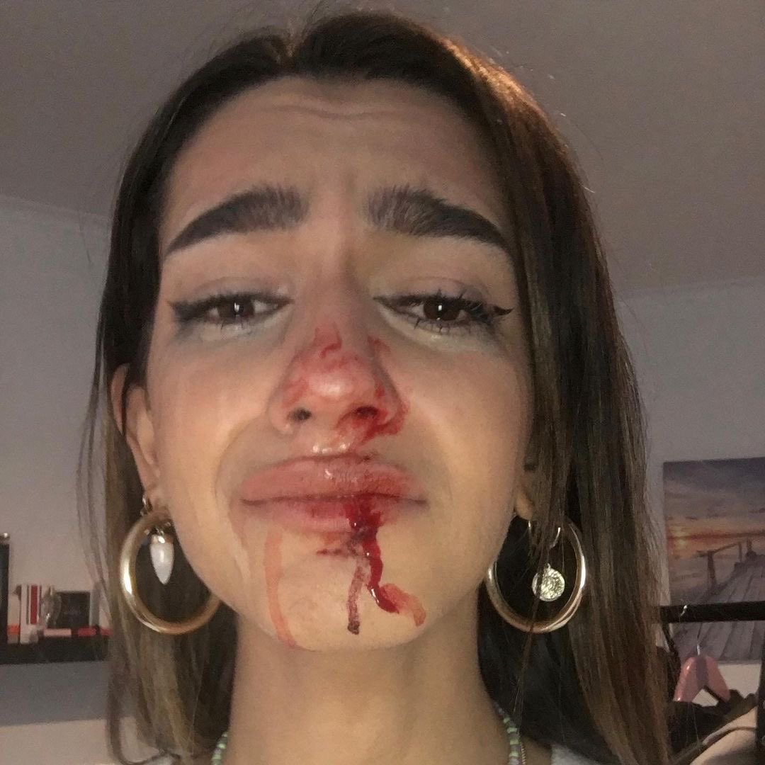 Los Mossos y la Fiscalía investigan una agresión transfóbica en Barcelona a una chica de 19 años