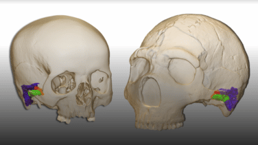 Una investigación española demuestra la existencia de personas con síndrome de Down en las comunidades neandertales