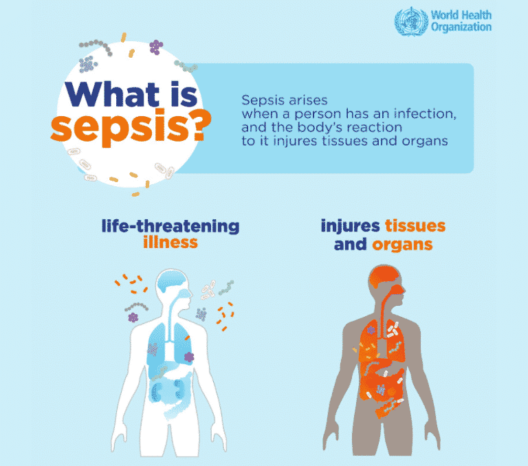 Día Mundial de la Sepsis: ¿en qué consiste esta enfermedad?