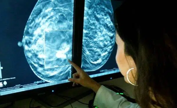 La Comisión Europea autoriza la comercialización para tratar el cáncer de mama