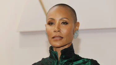 Alopecia cicatricial de origen autoinmune: la enfermedad que padece Jada Pinkett, mujer de Will Smith