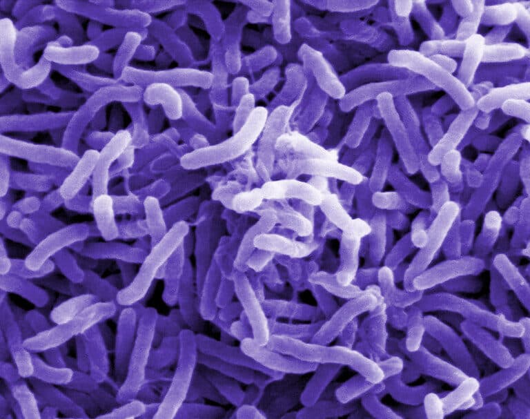 Cólera: síntomas, pronóstico y prevención para una enfermedad 'olvidada' en España