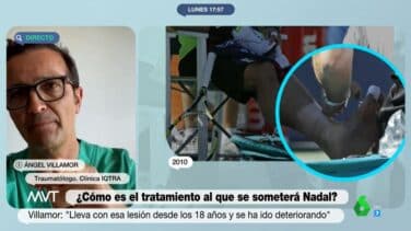 El doctor Ángel Villamor sobre la lesión de Nadal: "Es como si pisara una chincheta"