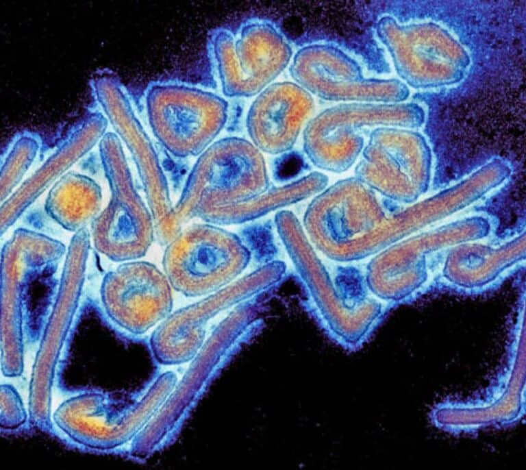 Así es la enfermedad del virus de Marburg, de la que Ghana ha decretado el primer brote