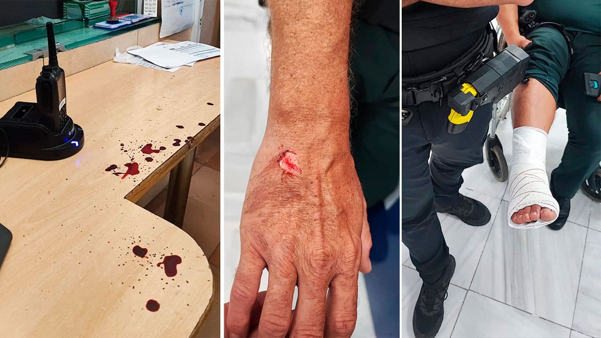 Imagenes de los guardias civiles agredidos el pasado sábado por la noche en Chiclana (Cádiz).