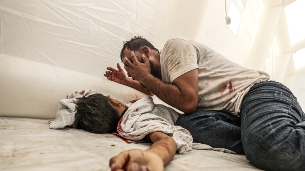 A man cries next to his dead son at Al Shifa Hospital