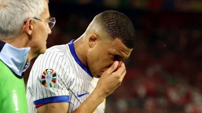 Mbappé regatea la operación tras romperse la nariz