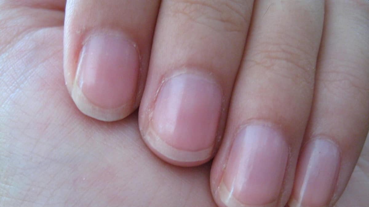 El significado oculto tras las rayas en las uñas, lo que revelan sobre tu salud /EFE