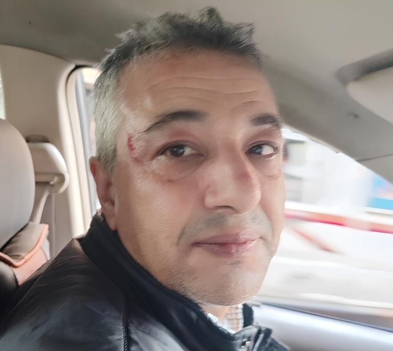 Agreden a un periodista saharaui en los territorios ocupados por Marruecos